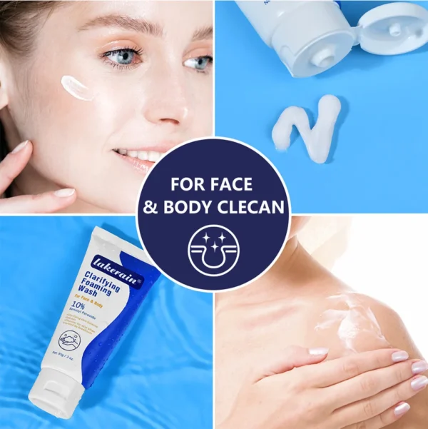 Acne Foaming Wash Benzoyl  For Face & Body Skin Care Wash - Image 6